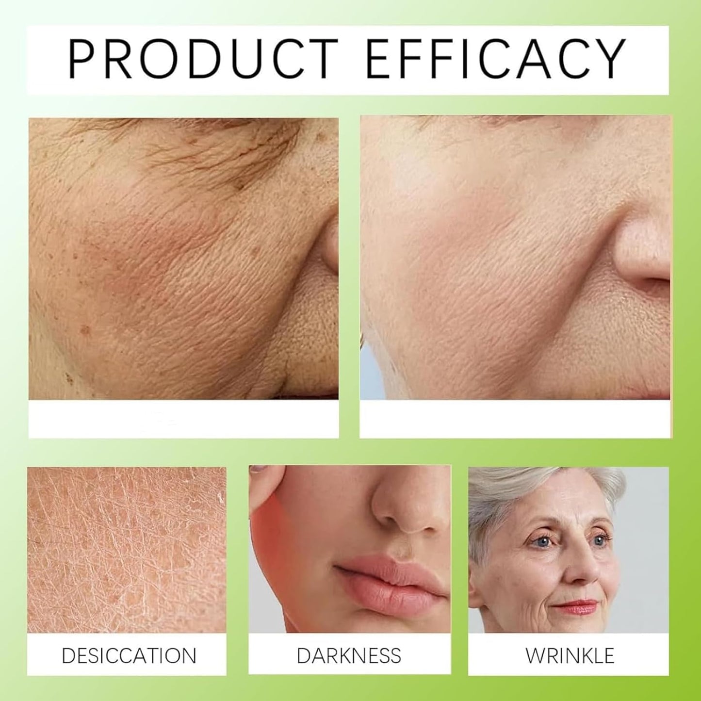 2Pcs Botoxmix & Vita-A Retinol Shot Wrinkle-Lift Tightening Cream, Vita-A Retinal Shot Tightening Booster for Wrinkles and Fine Lines, Retinol Shot for All Skin Types